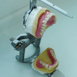 What is the best way to remove denture adhesive?