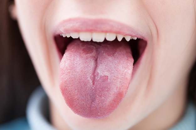 Worried  practically Burning Tongue Syndrome? What can you do?